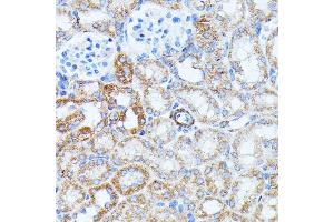 Immunohistochemistry of paraffin-embedded mouse kidney using KCNJ15 antibody (ABIN7269475) at dilution of 1:100 (40x lens).
