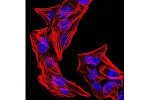 Immunofluorescence analysis of Hela cells using phospho-NLRC4(Ser-533) rat mAb.
