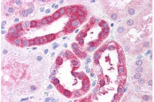 Human Renal Tubular Epithelium (formalin-fixed, paraffin-embedded) stained with RICTOR antibody ABIN297558 at 2. (RICTOR anticorps  (AA 1722-1732))