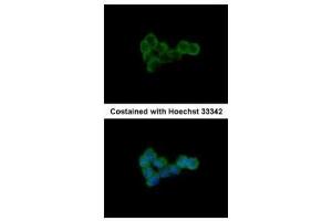ICC/IF Image Immunofluorescence analysis of methanol-fixed A431, using DLST, antibody at 1:500 dilution. (DLST anticorps  (Center))