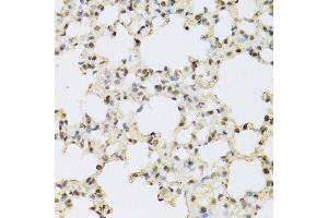 Immunohistochemistry of paraffin-embedded mouse lung using MAPK3 Antibody.