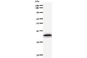 Western Blotting (WB) image for anti-Ubinuclein 1 (UBN1) antibody (ABIN930942) (Ubinuclein 1 anticorps)