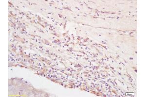 Formalin-fixed and paraffin embedded rat brain labeled with Rabbit Anti Integrin Alpha V + Beta 3 (CD51+CD61) Polyclonal Antibody, Unconjugated (ABIN674784) at 1:200 followed by conjugation to the secondary antibody and DAB staining