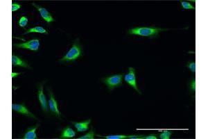 Immunofluorescence of purified MaxPab antibody to PDIA3 on HeLa cell.