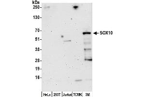 Western Blotting (WB) image for anti-SRY (Sex Determining Region Y)-Box 10 (SOX10) (AA 1-50) antibody (ABIN7450758)