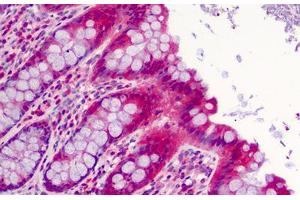 Human Colon: Formalin-Fixed, Paraffin-Embedded (FFPE) (SLFN12 anticorps  (C-Term))