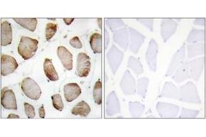 Immunohistochemistry analysis of paraffin-embedded human skeletal muscle tissue, using DUS2L Antibody. (DUSL2 anticorps  (AA 421-470))