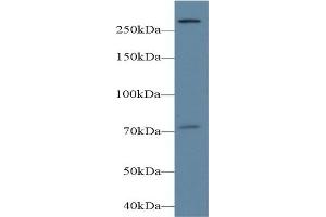 Detection of PLCe1 in Mouse Cerebrum lysate using Polyclonal Antibody to Phospholipase C Epsilon 1 (PLCe1) (PLCE1 anticorps  (AA 1-250))