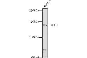 Western blot analysis of extracts of BxPC-3 cells, using IFIH1 antibody (ABIN6131879, ABIN6142174, ABIN6142175 and ABIN6217724) at 1:1000 dilution. (IFIH1 anticorps  (AA 1-205))
