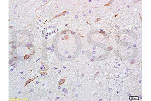 Formalin-fixed and rat brain tissue labeled with Anti-GABA Polyclonal Antibody, Unconjugated (ABIN679013) at 1:200 followed by conjugation to the secondary antibody and DAB staining (GABA anticorps)