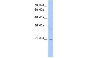 LOC728864 antibody used at 1 ug/ml to detect target protein. (LOC728864 (N-Term) anticorps)
