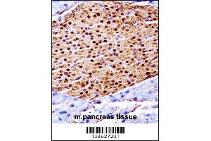 Mouse Scyl3 Antibody immunohistochemistry analysis in formalin fixed and paraffin embedded mouse pancreas tissue followed by peroxidase conjugation of the secondary antibody and DAB staining. (SCYL3 anticorps  (C-Term))