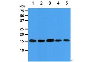 The cell lysates (40ug) were resolved by SDS-PAGE, transferred to PVDF membrane and probed with anti-human EIF5A antibody (1:1000).