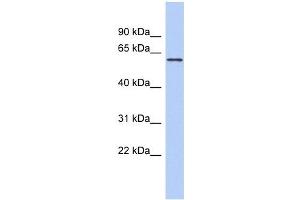 PDE4B antibody used at 1 ug/ml to detect target protein. (PDE4B anticorps)