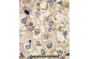 Immunohistochemistry (IHC) image for anti-Signal Sequence Receptor, alpha (SSR1) antibody (ABIN2997994)
