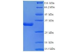 SDS-PAGE (SDS) image for Calcium Channel, Voltage-Dependent, alpha 2/delta Subunit 1 (CACNA2D1) (AA 528-668), (partial) protein (His-SUMO Tag) (ABIN5709179)