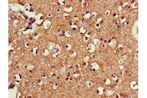 Immunohistochemistry of paraffin-embedded human brain tissue using ABIN7170561 at dilution of 1:100 (SAMD8 anticorps  (AA 1-152))