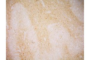 Immunohistochemistry of GCPII in human Medulla oblongata by monoclonal antibody.