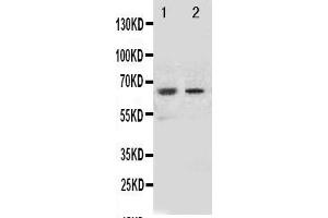 anti-NADPH Oxidase 1 (NOX1) (AA 354-374), (Middle Region) antibody