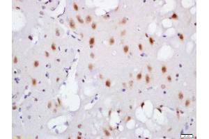 Formalin-fixed and paraffin embedded mouse brain labeled with Rabbit Anti-TNIK (Ser764) Polyclonal Antibody, Unconjugated (ABIN711941) at 1:200 followed by conjugation to the secondary antibody and DAB staining (TNIK anticorps  (pSer764))