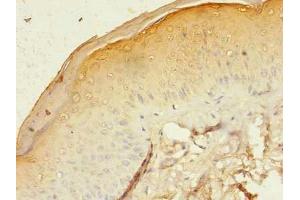 Immunohistochemistry of paraffin-embedded human skin tissue using ABIN7153613 at dilution of 1:100