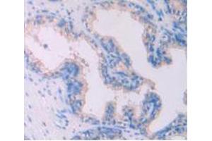 IHC-P analysis of Human Prostate Gland Tissue, with DAB staining. (IL-4 anticorps  (AA 25-153))