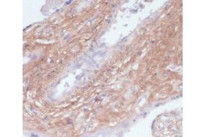 Immunohistochemistry of paraffin-embedded Human placenta using COL1A1 Polyclonal Antibody at dilution of 1:200 (40x lens). (COL1A1 anticorps)