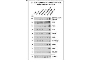 Study of cellular SIL1 immunoreactivity and presence of ER-stress in Hek293 cells overexpressing SIL1 or its variant forms.