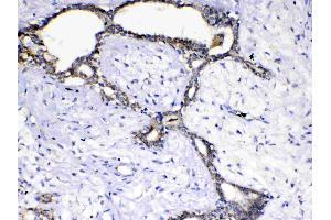 IHC analysis of SCF using anti-SCF antibody .