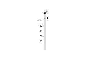 Anti-Nestin Antibody  at 1:2000 dilution + Hela whole cell lysate Lysates/proteins at 20 μg per lane.