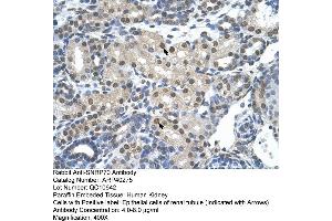 Immunohistochemistry (IHC) image for anti-Small Nuclear Ribonucleoprotein 70kDa (U1) (SNRNP70) (N-Term) antibody (ABIN2778715)