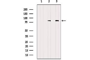 Western blot analysis of extracts from various samples, using ADD1 Antibody.
