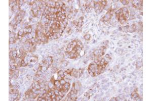 anti-Uronyl-2-Sulfotransferase (UST) antibody