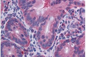 Mouse Small Intestine: Formalin-Fixed, Paraffin-Embedded (FFPE) (IL-10 anticorps)