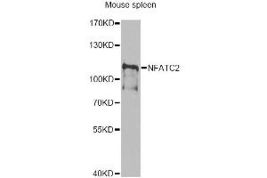 Western blot analysis of extracts of mouse spleen, using NFATC2 antibody (ABIN6292207) at 1:1000 dilution. (NFAT1 anticorps)