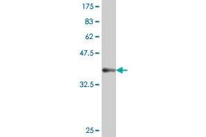 Western Blot detection against Immunogen (37.