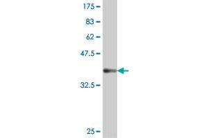 Western Blot detection against Immunogen (37. (NR1I2 anticorps  (AA 279-378))