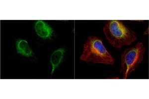 ICC/IF Image PDI antibody [N1N3] detects PDI protein at endoplasmic reticulum by immunofluorescent analysis. (P4HB anticorps)