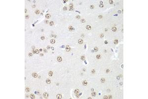 Immunohistochemistry of paraffin-embedded rat brain using PRMT5 antibody. (PRMT5 anticorps)