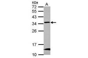 Image no. 1 for anti-Glioblastoma Amplified Sequence (GBAS) (AA 77-265) antibody (ABIN1498393)