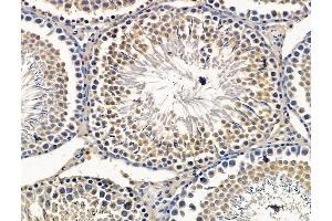 ABIN7096401 and ABIN7100465 at 1/100 staining rat testis tissue by IHC-P. (SPEF1 anticorps)