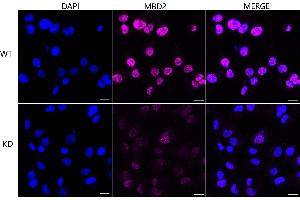 Immunocytochemical staining of HT- cells using MBD2 antibody (ABIN7799386), 1:1,000), Top panel: wild-type (WT), Bottom panal: MBD2 shRNA knockdown (KD). (Recombinant MBD2 anticorps)