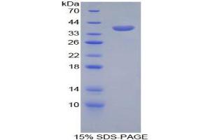 SDS-PAGE analysis of Mouse CPB1 Protein.