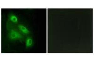 anti-EPS8-Like 3 (EPS8L3) antibody