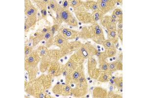 Immunohistochemistry of paraffin-embedded human liver injury using KIF1B Antibody.