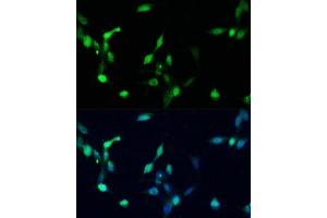 Immunofluorescence analysis of NIH/3T3 cells using p27 KIP 1 antibody (ABIN3020889, ABIN3020890, ABIN3020891 and ABIN6213779) at dilution of 1:100. (CDKN1B anticorps  (AA 1-198))