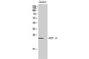 Western Blotting (WB) image for anti-A Kinase (PRKA) Anchor Protein 14 (AKAP14) (N-Term) antibody (ABIN3173725) (AKAP14 anticorps  (N-Term))