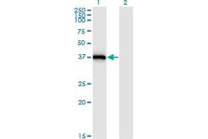 Western Blot analysis of STX16 expression in transfected 293T cell line by STX16 monoclonal antibody (M03), clone 3D12. (Syntaxin 16 anticorps  (AA 1-99))