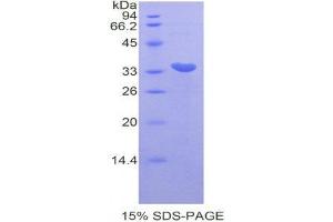 SDS-PAGE (SDS) image for Cyclin-Dependent Kinase 7 (CDK7) (AA 12-295) protein (His tag) (ABIN1878428)