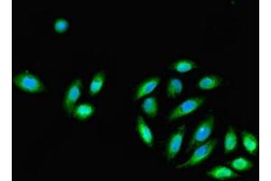 Immunofluorescent analysis of A549 cells using ABIN7145131 at dilution of 1:100 and Alexa Fluor 488-congugated AffiniPure Goat Anti-Rabbit IgG(H+L)